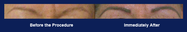 Permanent Makeup - Eyeliner